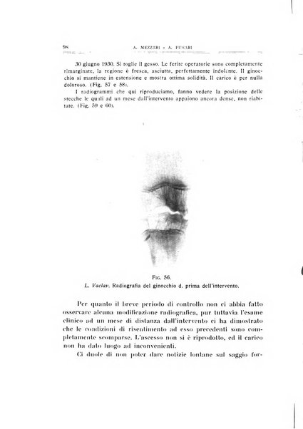 Archivio di ortopedia pubblicazione ufficiale del Pio istituto dei rachitici <1924-1950>