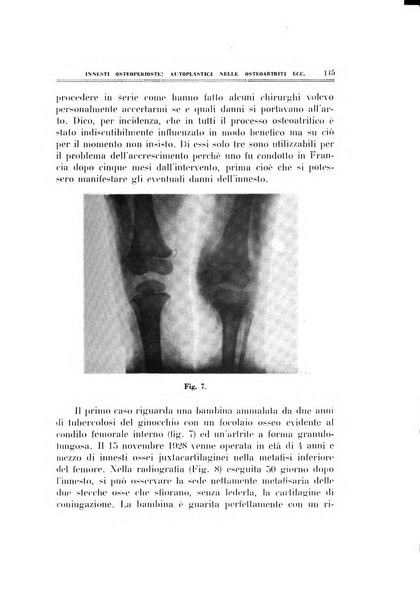 Archivio di ortopedia pubblicazione ufficiale del Pio istituto dei rachitici <1924-1950>