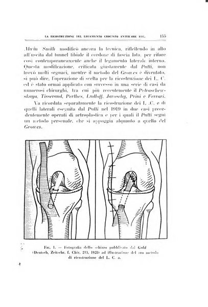 Archivio di ortopedia pubblicazione ufficiale del Pio istituto dei rachitici <1924-1950>