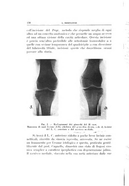 Archivio di ortopedia pubblicazione ufficiale del Pio istituto dei rachitici <1924-1950>