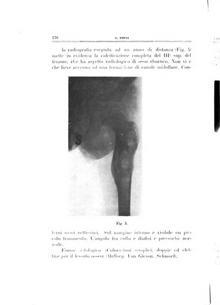 Archivio di ortopedia pubblicazione ufficiale del Pio istituto dei rachitici <1924-1950>