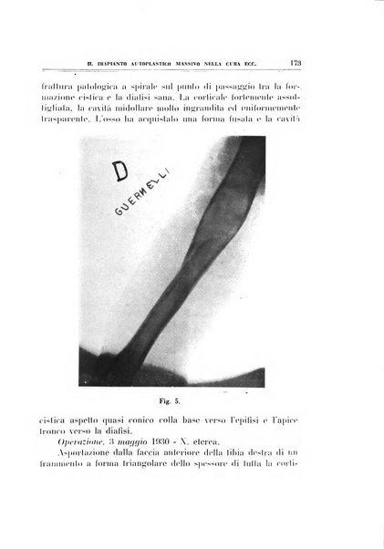 Archivio di ortopedia pubblicazione ufficiale del Pio istituto dei rachitici <1924-1950>