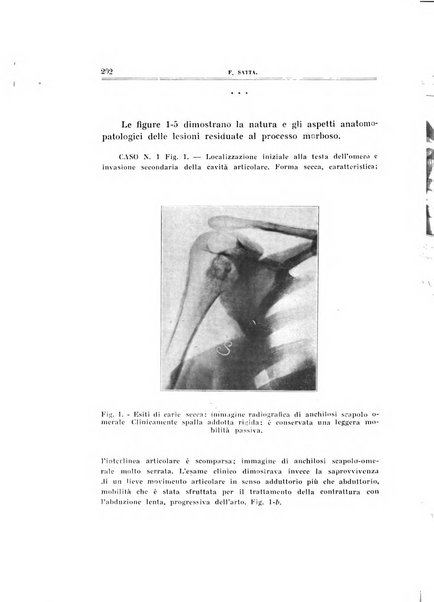 Archivio di ortopedia pubblicazione ufficiale del Pio istituto dei rachitici <1924-1950>