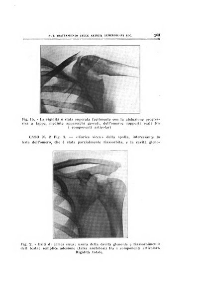 Archivio di ortopedia pubblicazione ufficiale del Pio istituto dei rachitici <1924-1950>