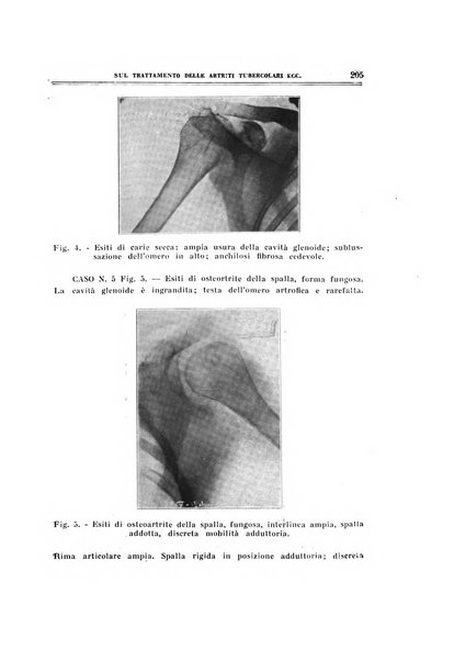 Archivio di ortopedia pubblicazione ufficiale del Pio istituto dei rachitici <1924-1950>