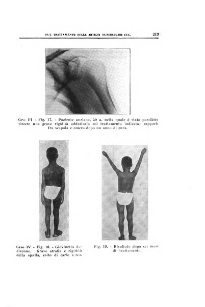 Archivio di ortopedia pubblicazione ufficiale del Pio istituto dei rachitici <1924-1950>