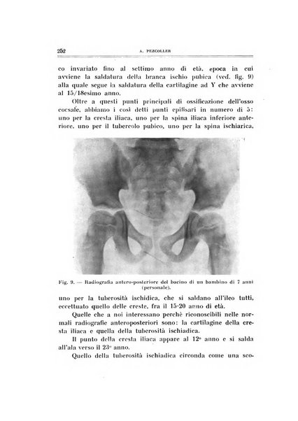 Archivio di ortopedia pubblicazione ufficiale del Pio istituto dei rachitici <1924-1950>