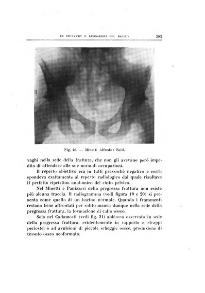 Archivio di ortopedia pubblicazione ufficiale del Pio istituto dei rachitici <1924-1950>