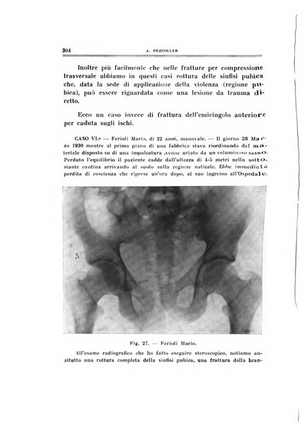 Archivio di ortopedia pubblicazione ufficiale del Pio istituto dei rachitici <1924-1950>