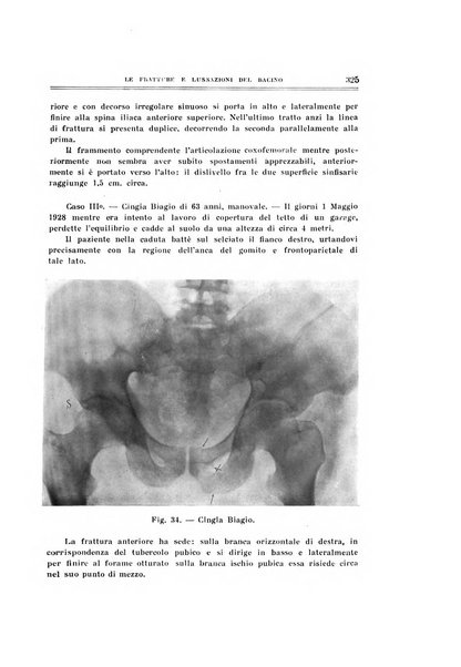 Archivio di ortopedia pubblicazione ufficiale del Pio istituto dei rachitici <1924-1950>