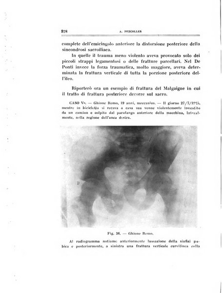 Archivio di ortopedia pubblicazione ufficiale del Pio istituto dei rachitici <1924-1950>