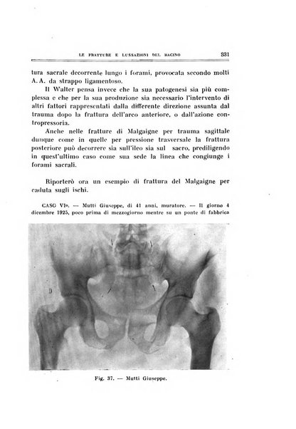 Archivio di ortopedia pubblicazione ufficiale del Pio istituto dei rachitici <1924-1950>