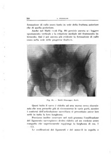 Archivio di ortopedia pubblicazione ufficiale del Pio istituto dei rachitici <1924-1950>