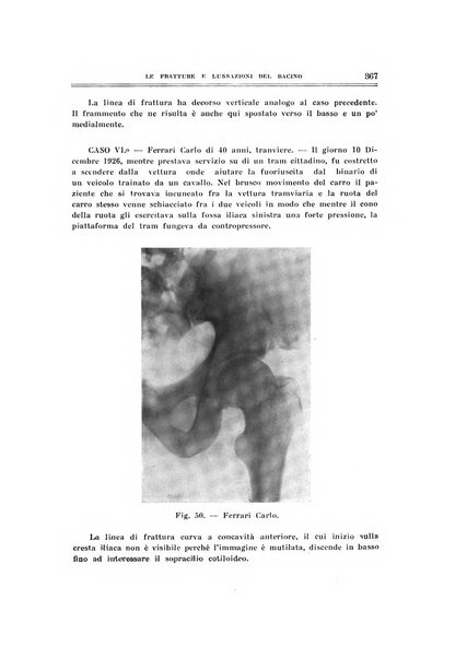 Archivio di ortopedia pubblicazione ufficiale del Pio istituto dei rachitici <1924-1950>