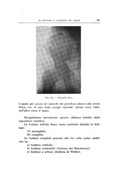 Archivio di ortopedia pubblicazione ufficiale del Pio istituto dei rachitici <1924-1950>