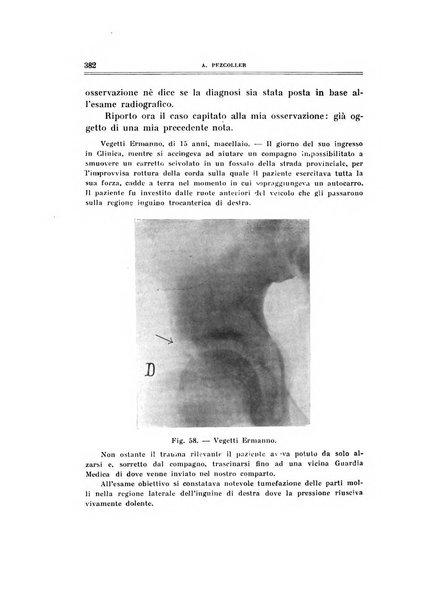 Archivio di ortopedia pubblicazione ufficiale del Pio istituto dei rachitici <1924-1950>