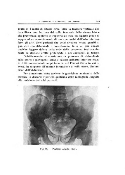 Archivio di ortopedia pubblicazione ufficiale del Pio istituto dei rachitici <1924-1950>