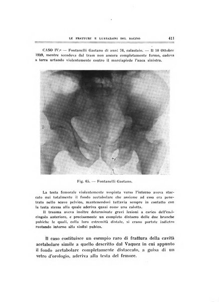 Archivio di ortopedia pubblicazione ufficiale del Pio istituto dei rachitici <1924-1950>