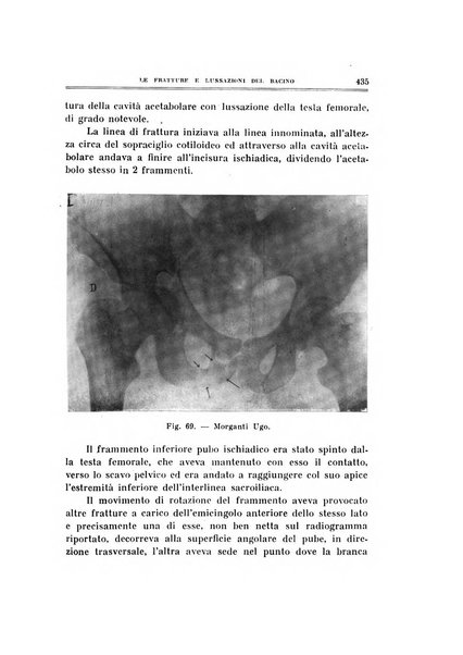 Archivio di ortopedia pubblicazione ufficiale del Pio istituto dei rachitici <1924-1950>