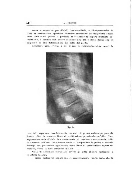 Archivio di ortopedia pubblicazione ufficiale del Pio istituto dei rachitici <1924-1950>