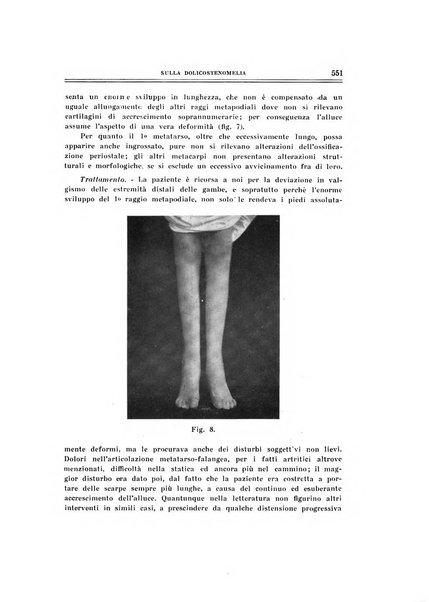 Archivio di ortopedia pubblicazione ufficiale del Pio istituto dei rachitici <1924-1950>