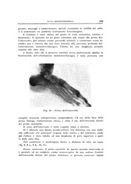 Archivio di ortopedia pubblicazione ufficiale del Pio istituto dei rachitici <1924-1950>