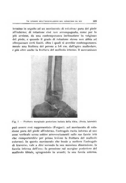 Archivio di ortopedia pubblicazione ufficiale del Pio istituto dei rachitici <1924-1950>