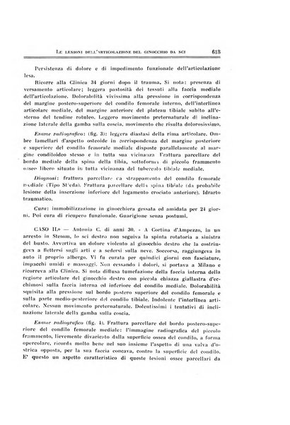 Archivio di ortopedia pubblicazione ufficiale del Pio istituto dei rachitici <1924-1950>