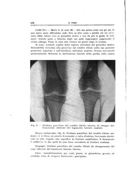 Archivio di ortopedia pubblicazione ufficiale del Pio istituto dei rachitici <1924-1950>