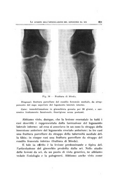 Archivio di ortopedia pubblicazione ufficiale del Pio istituto dei rachitici <1924-1950>