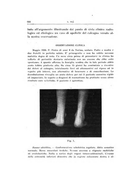 Archivio di ortopedia pubblicazione ufficiale del Pio istituto dei rachitici <1924-1950>