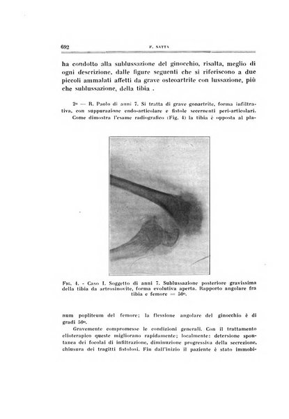 Archivio di ortopedia pubblicazione ufficiale del Pio istituto dei rachitici <1924-1950>