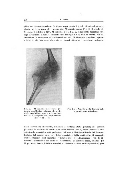 Archivio di ortopedia pubblicazione ufficiale del Pio istituto dei rachitici <1924-1950>