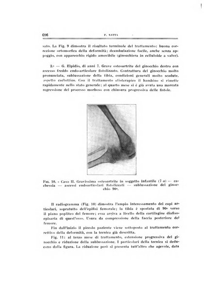 Archivio di ortopedia pubblicazione ufficiale del Pio istituto dei rachitici <1924-1950>