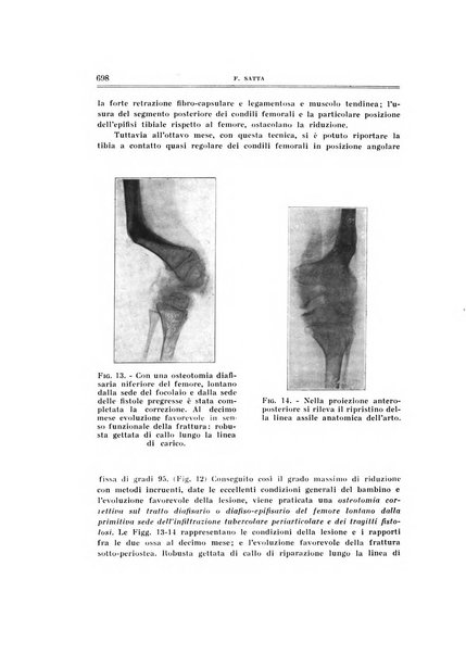 Archivio di ortopedia pubblicazione ufficiale del Pio istituto dei rachitici <1924-1950>