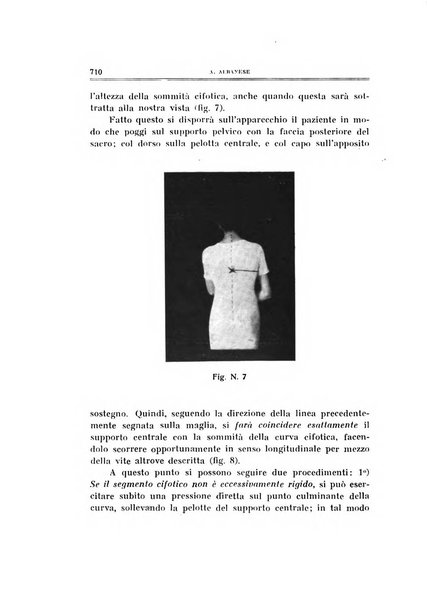 Archivio di ortopedia pubblicazione ufficiale del Pio istituto dei rachitici <1924-1950>