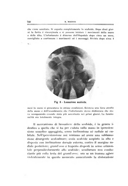 Archivio di ortopedia pubblicazione ufficiale del Pio istituto dei rachitici <1924-1950>