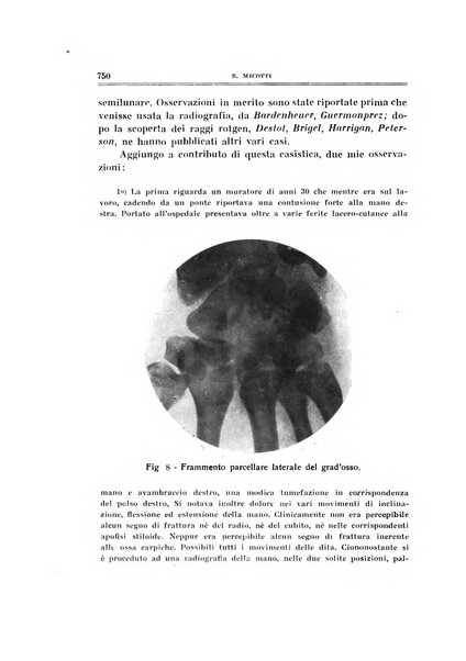 Archivio di ortopedia pubblicazione ufficiale del Pio istituto dei rachitici <1924-1950>