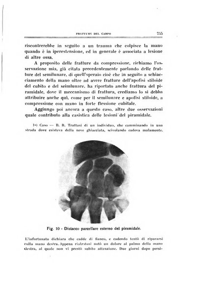 Archivio di ortopedia pubblicazione ufficiale del Pio istituto dei rachitici <1924-1950>