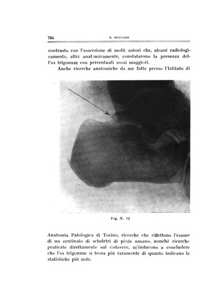 Archivio di ortopedia pubblicazione ufficiale del Pio istituto dei rachitici <1924-1950>