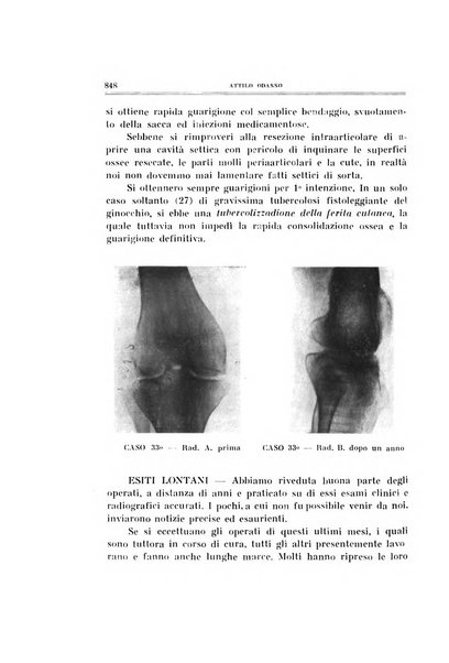 Archivio di ortopedia pubblicazione ufficiale del Pio istituto dei rachitici <1924-1950>