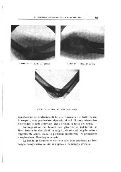 Archivio di ortopedia pubblicazione ufficiale del Pio istituto dei rachitici <1924-1950>