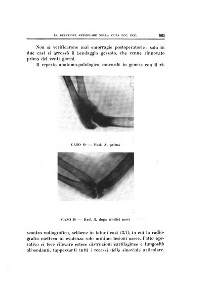 Archivio di ortopedia pubblicazione ufficiale del Pio istituto dei rachitici <1924-1950>