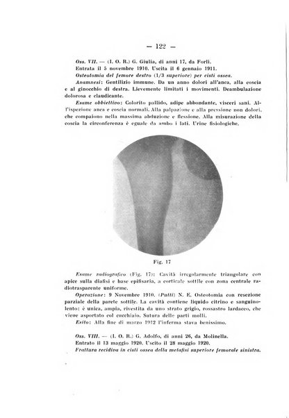 Archivio di ortopedia pubblicazione ufficiale del Pio istituto dei rachitici <1924-1950>