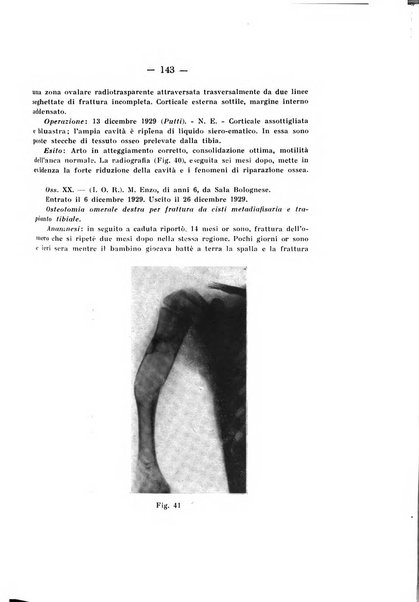 Archivio di ortopedia pubblicazione ufficiale del Pio istituto dei rachitici <1924-1950>