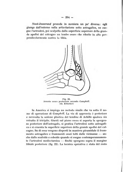 Archivio di ortopedia pubblicazione ufficiale del Pio istituto dei rachitici <1924-1950>