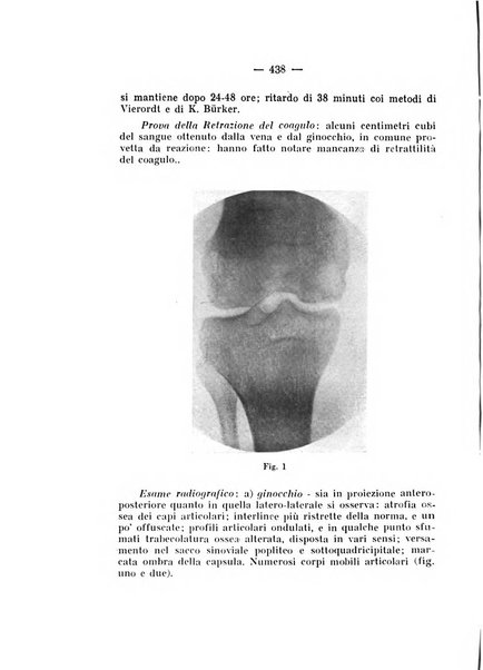 Archivio di ortopedia pubblicazione ufficiale del Pio istituto dei rachitici <1924-1950>