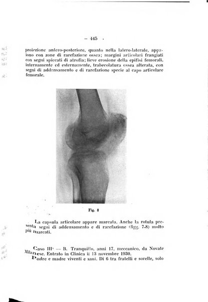 Archivio di ortopedia pubblicazione ufficiale del Pio istituto dei rachitici <1924-1950>