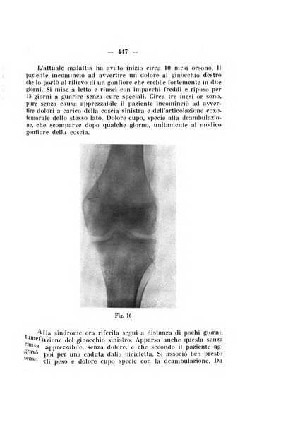 Archivio di ortopedia pubblicazione ufficiale del Pio istituto dei rachitici <1924-1950>