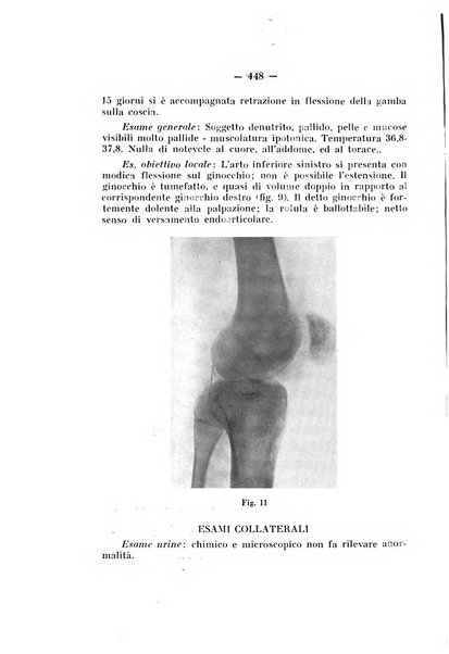 Archivio di ortopedia pubblicazione ufficiale del Pio istituto dei rachitici <1924-1950>